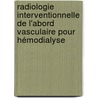 Radiologie interventionnelle de l'abord vasculaire pour hémodialyse door Luc Turmel