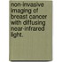 Non-Invasive Imaging Of Breast Cancer With Diffusing Near-Infrared Light.