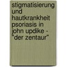 Stigmatisierung Und Hautkrankheit Psoriasis In John Updike - "Der Zentaur" by Anonym