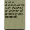 Atlas Of Diseases Of The Skin; Including An Epitome Of Pathology And Treatment by Franz Mra Ek