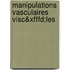 Manipulations Vasculaires Visc&xfffd;les