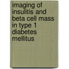 Imaging of insulitis and beta cell mass in type 1 diabetes mellitus door Valentina Di Gialleonardo