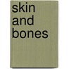 Skin and Bones by Kevin Loewen