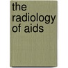 The Radiology Of Aids door A. Banerjee