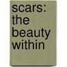 Scars: The Beauty Within by Jacqueline J. Worrell