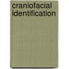 Craniofacial Identification door Christopher Wilkinson