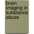 Brain Imaging in Substance Abuse