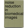 Noise Reduction in Biomedical Images by Vikas Gupta