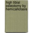 High Tibial Osteotomy By Hemicallotasis