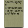 Neurosurgery Of Arteriovenous Malformations And Fistulas door R. Schmid-Elsaesser
