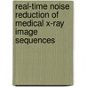 Real-Time Noise Reduction of Medical X-Ray Image Sequences door Marc Hensel