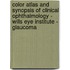 Color Atlas And Synopsis Of Clinical Ophthalmology - Wills Eye Institute - Glaucoma