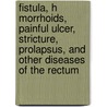 Fistula, H Morrhoids, Painful Ulcer, Stricture, Prolapsus, and Other Diseases of the Rectum door William Allingiham
