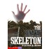 Runaway Skeleton