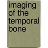 Imaging of the Temporal Bone door Laurie Loevner