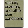 Rashes, Eczema, and Other Skin Conditions door Editors Of Adams Media
