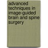 Advanced Techniques in Image-Guided Brain and Spine Surgery door Isabelle Germano