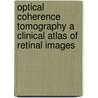Optical Coherence Tomography a Clinical Atlas of Retinal Images door Deb Landry