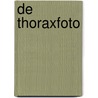 De thoraxfoto door S.M. de Hosson