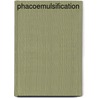 Phacoemulsification by Soosan Jacob