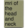 Mri Of The Head And Neck by Thomas J. Vogl