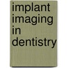 Implant Imaging in Dentistry door Laxmikanth Chatra