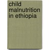 Child Malnutrition in Ethiopia door Haregewoin Mirotaw