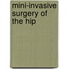 Mini-Invasive Surgery Of The Hip door Dg Poitout