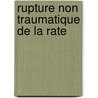 Rupture non traumatique de la rate by Dr Frederic Enjaume