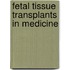 Fetal Tissue Transplants In Medicine