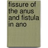 Fissure of the Anus and Fistula in Ano door Lewis H. Adler
