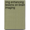 Ring Enhancing Lesions On Brain Imaging door Ankur Gupta