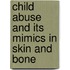 Child Abuse and Its Mimics in Skin and Bone