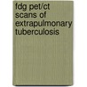 Fdg Pet/ct Scans Of Extrapulmonary Tuberculosis door Moshi Geso