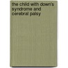 The Child with Down's Syndrome and Cerebral Palsy door Margaret Selpha Amateshe