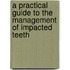 A Practical Guide to the Management of Impacted Teeth