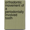 Orthodontic Movement Of A Periodontally Involved Tooth door Dr. Anupam Agarwal