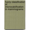 Fuzzy Classification of Microcalcification in Mammograms door Agustinus Praba Drijarkara