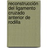 Reconstrucción del Ligamento Cruzado Anterior de Rodilla door Manuel Malillos