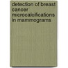 Detection of Breast Cancer Microcalcifications in Mammograms door Ayman Abubaker