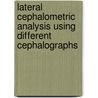 Lateral Cephalometric Analysis Using Different Cephalographs by Ruba Jassim