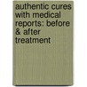Authentic Cures with Medical Reports: Before & After Treatment door Subrata Kumar Banerjea