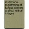 Multimodal Registration Of Fundus Camera And Oct Retinal Images door Ondrej Beták