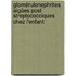 glomérulonephrites aigües post streptococciques chez l'enfant