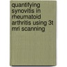Quantifying Synovitis In Rheumatoid Arthritis Using 3t Mri Scanning door Arista Chand