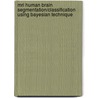 Mri Human Brain Segmentation/classification Using Bayesian Technique door Soodabeh Safa