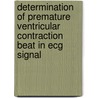 Determination Of Premature Ventricular Contraction  Beat In Ecg Signal door Tahsina Farah Sanam