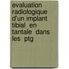 Evaluation Radiologique D'un Implant Tibial  En Tantale  Dans Les  Ptg door LoïC. Le Coz
