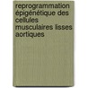 Reprogrammation épigénétique des cellules musculaires lisses aortiques door Delphine Gomez