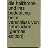 Die Halbkrone Und Ihre Bedeutung Beim Verschluss Von Zahnlücken (German Edition) door Rank Alfred